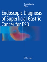 Abbildung von: Endoscopic Diagnosis of Superficial Gastric Cancer for ESD - Springer