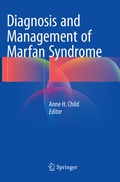 Bild: Diagnosis and Management of Marfan Syndrome - Springer