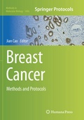 Cover: Breast Cancer - Humana Press Inc.