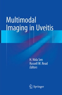 Enlarge image Cover: Multimodal Imaging in Uveitis - Springer