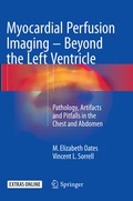 Cover: Myocardial Perfusion Imaging - Beyond the Left Ventricle - Springer
