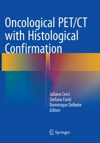Abbildung von: Oncological PET/CT with Histological Confirmation - Springer