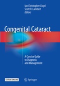 Cover: Congenital Cataract - Springer