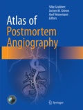 Cover: Atlas of Postmortem Angiography - Springer