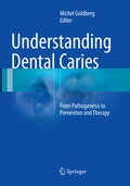 Cover: Understanding Dental Caries - Springer