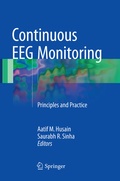 Bild: Continuous EEG Monitoring - Springer