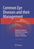 Cover: Common Eye Diseases and their Management - Springer