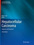 Cover: Hepatocellular Carcinoma - Springer