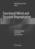 Bild: Functional Mitral and Tricuspid Regurgitation - Springer