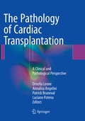 Cover: The Pathology of Cardiac Transplantation - Springer