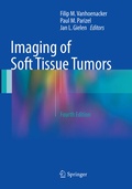 Cover: Imaging of Soft Tissue Tumors - Springer