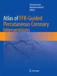 Abbildung von: Atlas of FFR-Guided Percutaneous Coronary Interventions - Springer