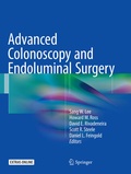 Cover: Advanced Colonoscopy and Endoluminal Surgery - Springer