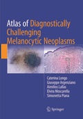 Cover: Atlas of Diagnostically Challenging Melanocytic Neoplasms - Springer