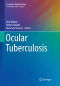 Cover: Ocular Tuberculosis - Springer