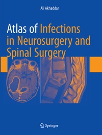 Enlarge image Cover: Atlas of Infections in Neurosurgery and Spinal Surgery - Springer