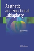 Cover: Aesthetic and Functional Labiaplasty - Springer
