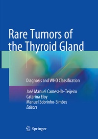 Bild vergrößern Bild: Rare Tumors of the Thyroid Gland - Springer