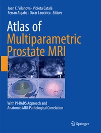 Bild vergrößern Bild: Atlas of Multiparametric Prostate MRI - Springer
