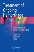 Cover: Treatment of Ongoing Hemorrhage - Springer