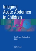Cover: Imaging Acute Abdomen in Children - Springer