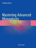 Cover: Mastering Advanced Rhinoplasty - Springer