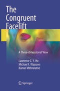 Cover: The Congruent Facelift - Springer