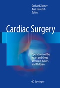 Bild: Cardiac Surgery - Springer