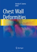 Bild: Chest Wall Deformities - Springer