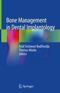 Cover: Bone Management in Dental Implantology - Springer