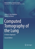 Cover: Computed Tomography of the Lung - Springer