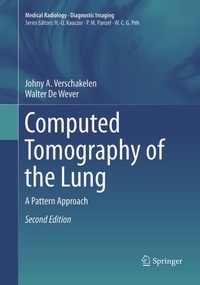 Abbildung von: Computed Tomography of the Lung - Springer