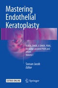 Cover: Mastering Endothelial Keratoplasty - Springer