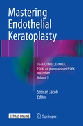 Cover: Mastering Endothelial Keratoplasty - Springer