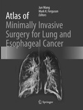 Bild: Atlas of Minimally Invasive Surgery for Lung and Esophageal Cancer - Springer