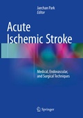 Abbildung von: Acute Ischemic Stroke - Springer