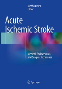 Abbildung von: Acute Ischemic Stroke - Springer