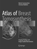 Cover: Atlas of Breast Tomosynthesis - Springer
