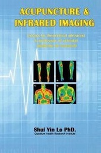 Abbildung von: Acupuncture and Infrared Imaging - Ehgbooks