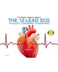 Cover: The 12-Lead ECG in Acute Coronary Syndromes - Mosby/JEMS