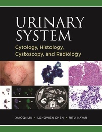 Abbildung von: Urinary System: Cytology, Histology, Cystoscopy, and Radiology - PMPH USA, Ltd.