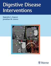 Abbildung von: Digestive Disease Interventions - Thieme Publishers