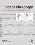 Cover: Brugada Phenocopy - Academic Press