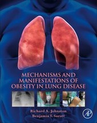 Abbildung von: Mechanisms and Manifestations of Obesity in Lung Disease - Academic Press