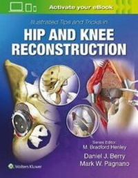 Enlarge image Cover: Illustrated Tips and Tricks in Hip and Knee Reconstructive and Replacement Surgery - Lippincott Williams and Wilkins