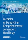 Cover: Medialer unikondyl&auml;rer Kniegelenkersatz: zementiert, fixed Inlay - Springer