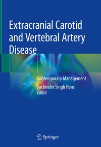 Abbildung von: Extracranial Carotid and Vertebral Artery Disease - Springer