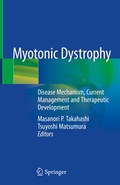Bild: Myotonic Dystrophy - Springer