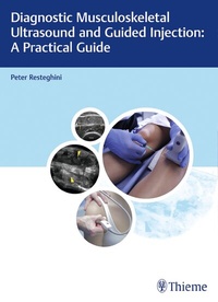 Abbildung von: Diagnostic Musculoskeletal Ultrasound and Guided Injection: A Practical Guide - Thieme