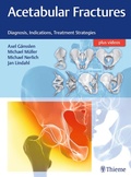 Cover: Acetabular Fractures - Thieme